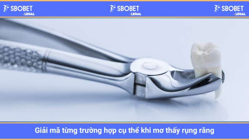 Giải mã từng trường hợp cụ thể khi mơ thấy rụng răng